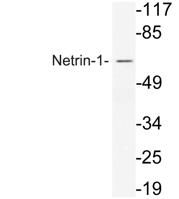Western blot of Netrin-1 (Q533) pAb in extracts from COS7 cells.