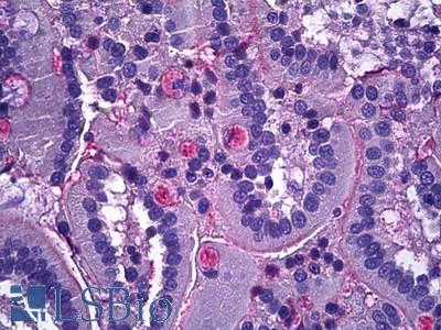 Anti-Netrin 1 antibody IHC of human intestine. Immunohistochemistry of formalin-fixed, paraffin-embedded tissue after heat-induced antigen retrieval. Antibody LS-B5912 concentration 3.75 ug/ml.