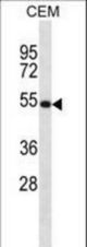 NTN3 Antibody western blot of CEM cell line lysates (35 ug/lane). The NTN3 antibody detected the NTN3 protein (arrow).