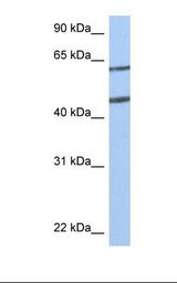 MCF7 cell lysate. Antibody concentration: 1.0 ug/ml. Gel concentration: 12%.