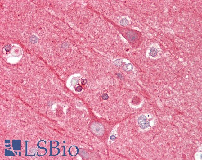 Anti-NTNG2 / Netrin G2 antibody IHC staining of human brain, cortex. Immunohistochemistry of formalin-fixed, paraffin-embedded tissue after heat-induced antigen retrieval.