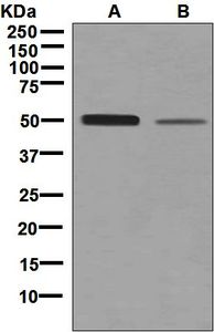 Western blot analysis on (A) fetal brain and (B) Jurkat lysates using anti-NTNG2 / Netrin G2 antibody.