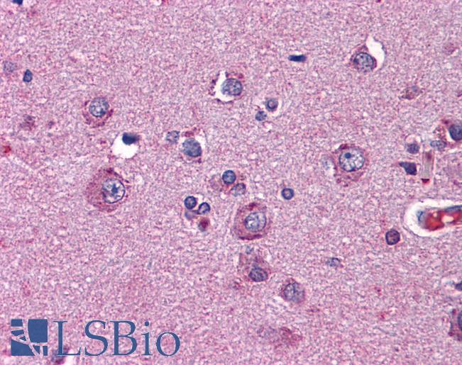 Anti-NTNG2 / Netrin G2 antibody IHC of human brain, cortex. Immunohistochemistry of formalin-fixed, paraffin-embedded tissue after heat-induced antigen retrieval. Antibody LS-B4540 concentration 2.5 ug/ml.