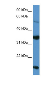 NTNG2 / Netrin G2 antibody LS-C135778 Western blot of HepG2 cell lysate.