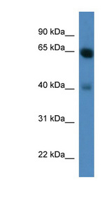 NTRK2 / TRKB antibody LS-C135253 Western blot of Fetal Heart lysate.