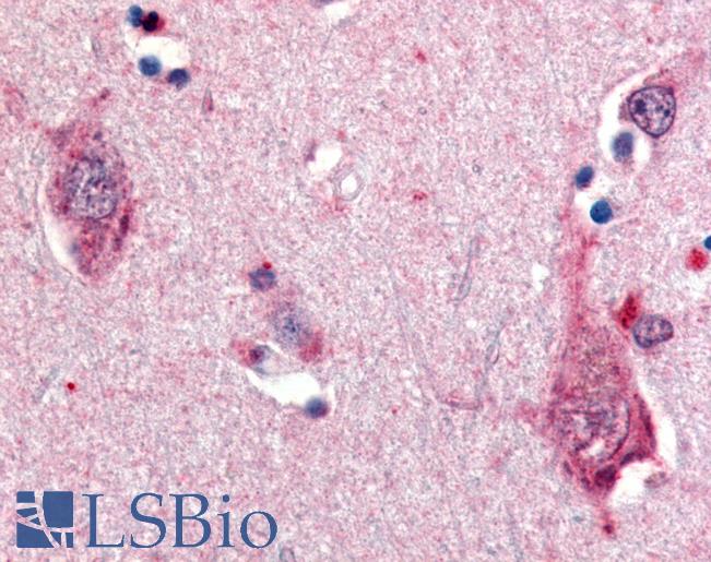 Anti-NTRK2 / TRKB antibody LS-A9401 IHC of human brain, neurons. Immunohistochemistry of formalin-fixed, paraffin-embedded tissue after heat-induced antigen retrieval.