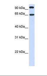 Fetal liver lysate. Antibody concentration: 1.0 ug/ml. Gel concentration: 12%.