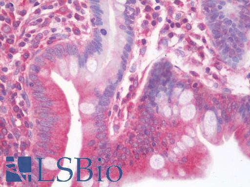 Anti-NTRK3 / TRKC antibody IHC staining of human small intestine. Immunohistochemistry of formalin-fixed, paraffin-embedded tissue after heat-induced antigen retrieval. Antibody LS-B10709 dilution 1:75.