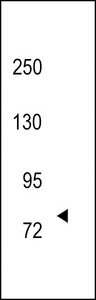 Western blot of hTRKC-C45 in 293 cell line lysates (35 ug/lane). TRKC (arrow) was detected using the purified antibody.