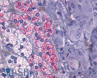 Anti-NTSR1 / NTR antibody IHC of human Adrenal, Pheochromocytoma. Immunohistochemistry of formalin-fixed, paraffin-embedded tissue after heat-induced antigen retrieval.