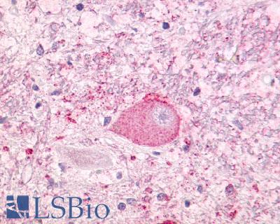Anti-NTSR1 antibody LS-A938 IHC of human brain, neurons and glia. Immunohistochemistry of formalin-fixed, paraffin-embedded tissue after heat-induced antigen retrieval.