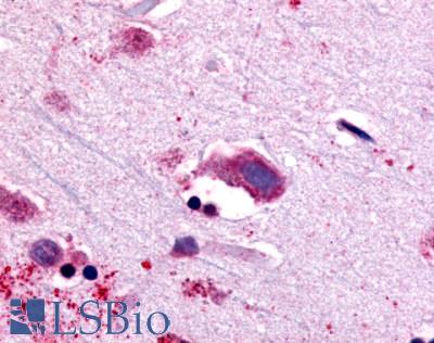 Anti-NTSR1 antibody LS-A939 IHC of human brain, neurons and glia. Immunohistochemistry of formalin-fixed, paraffin-embedded tissue after heat-induced antigen retrieval.