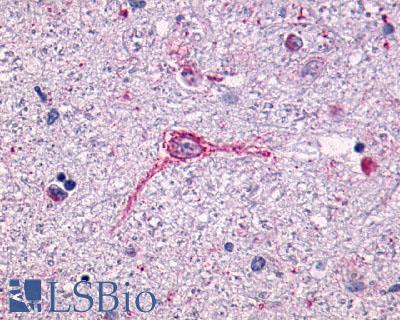 Anti-NTSR1 antibody LS-A935 IHC of human brain, neurons and glia. Immunohistochemistry of formalin-fixed, paraffin-embedded tissue after heat-induced antigen retrieval.