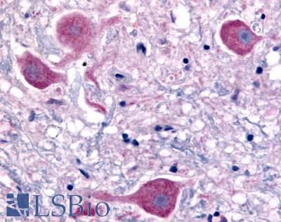 Anti-NTSR2 antibody LS-A3747 IHC of human brain, neurons. Immunohistochemistry of formalin-fixed, paraffin-embedded tissue after heat-induced antigen retrieval.