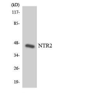 Western blot of the lysates from HeLa cells using NTR2 antibody.