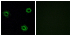 Immunofluorescence of A549 cells, using NTR2 Antibody. The picture on the right is treated with the synthesized peptide.