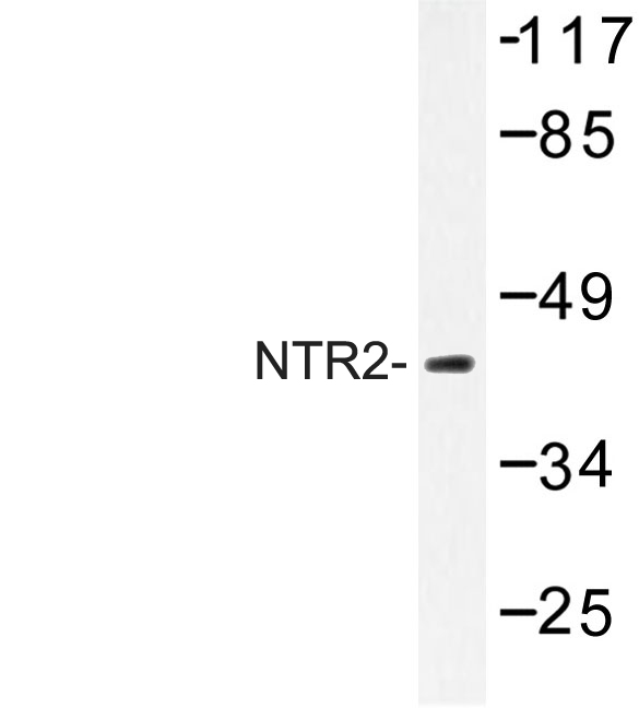 Western blot of NTR2 (D184) pAb in extracts from Jurkat cells.