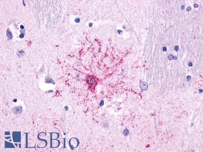 Anti-NTSR2 antibody LS-A1269 IHC of human brain, protoplasmic astrocyte. Immunohistochemistry of formalin-fixed, paraffin-embedded tissue after heat-induced antigen retrieval.