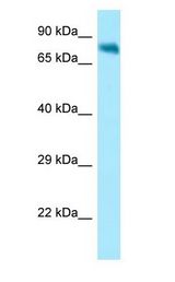 NUAK1 / ARK5 antibody Western Blot of HepG2.
