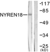 Western blot of extracts from COS7 cells, using NYREN18 Antibody. The lane on the right is treated with the synthesized peptide.