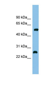 MEF2D antibody LS-C116168 Western blot of Fetal Kidney lysate.