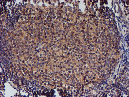 IHC of paraffin-embedded Human tonsil using anti-NUBPL mouse monoclonal antibody. (Heat-induced epitope retrieval by 10mM citric buffer, pH6.0, 100C for 10min).