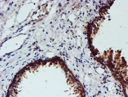 IHC of paraffin-embedded Human prostate tissue using anti-NUBPL mouse monoclonal antibody. (Heat-induced epitope retrieval by 10mM citric buffer, pH6.0, 100C for 10min).