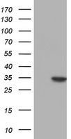 HEK293T cells were transfected with the pCMV6-ENTRY control (Left lane) or pCMV6-ENTRY NUBPL (Right lane) cDNA for 48 hrs and lysed. Equivalent amounts of cell lysates (5 ug per lane) were separated by SDS-PAGE and immunoblotted with anti-NUBPL.