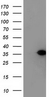 HEK293T cells were transfected with the pCMV6-ENTRY control (Left lane) or pCMV6-ENTRY NUBPL (Right lane) cDNA for 48 hrs and lysed. Equivalent amounts of cell lysates (5 ug per lane) were separated by SDS-PAGE and immunoblotted with anti-NUBPL.