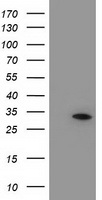 HEK293T cells were transfected with the pCMV6-ENTRY control (Left lane) or pCMV6-ENTRY NUBPL (Right lane) cDNA for 48 hrs and lysed. Equivalent amounts of cell lysates (5 ug per lane) were separated by SDS-PAGE and immunoblotted with anti-NUBPL.