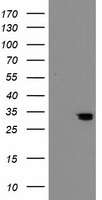HEK293T cells were transfected with the pCMV6-ENTRY control (Left lane) or pCMV6-ENTRY NUBPL (Right lane) cDNA for 48 hrs and lysed. Equivalent amounts of cell lysates (5 ug per lane) were separated by SDS-PAGE and immunoblotted with anti-NUBPL.