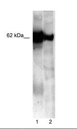 1. IP of HeLa Cell Lysate, 2. HeLa Cell Lysate