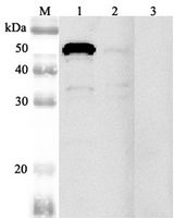 Western blot analysis using anti-NUCB2 (mouse), pAb at 1:2000 dilution. 1: Mouse NUCB2 (His-tagged). 2: Mouse prostate (seminal plasma). 3: Mouse RBP4 (His-tagged) (negative control).