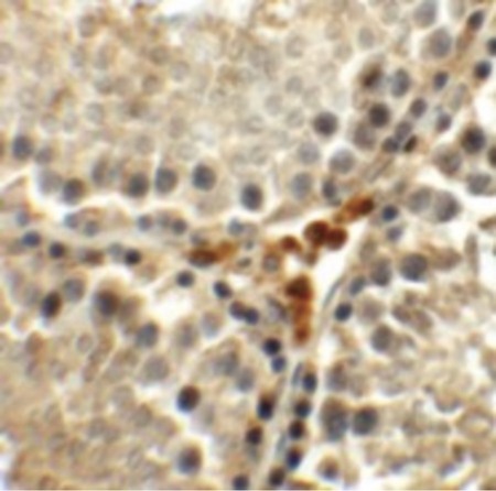 Immunohistochemistry of MEIG1 in rat testis tissue with MEIG1 antibody at 5 ug/ml.