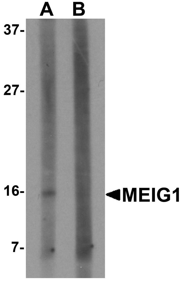 Western blot analysis of MEIG in K562 cell lysate with MEIG antibody at 1 ug/ml in (A) the absence and (B) the presence of blocking peptide.