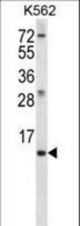 MEIG1 Antibody western blot of K562 cell line lysates (35 ug/lane). The MEIG1 antibody detected the MEIG1 protein (arrow).