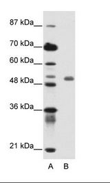 A: Marker, B: Jurkat Cell Lysate