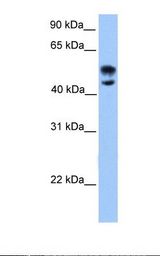 Fetal brain lysate. Antibody concentration: 1.0 ug/ml. Gel concentration: 12%.