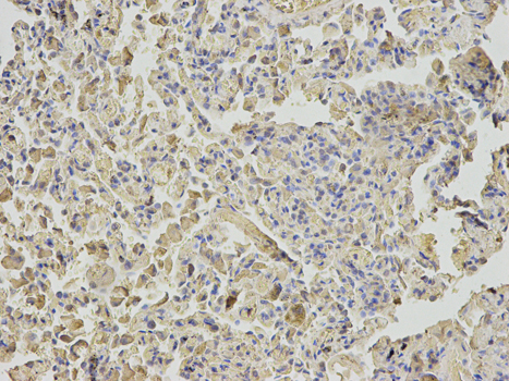 Immunohistochemistry of paraffin-embedded human lung using NUDT1 antibody at dilution of 1:200 (200x lens).