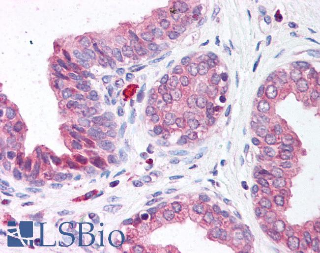 Anti-NUDT1 / MTH1 antibody IHC of human prostate. Immunohistochemistry of formalin-fixed, paraffin-embedded tissue after heat-induced antigen retrieval. Antibody LS-B264 concentration 5 ug/ml.
