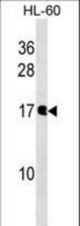 NUDT10 Antibody western blot of HL-60 cell line lysates (35 ug/lane). The NUDT10 Antibody detected the NUDT10 protein (arrow).