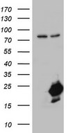 HEK293T cells were transfected with the pCMV6-ENTRY control (Left lane) or pCMV6-ENTRY NUDT10 (Right lane) cDNA for 48 hrs and lysed. Equivalent amounts of cell lysates (5 ug per lane) were separated by SDS-PAGE and immunoblotted with anti-NUDT10.
