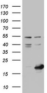 HEK293T cells were transfected with the pCMV6-ENTRY control (Left lane) or pCMV6-ENTRY NUDT10 (Right lane) cDNA for 48 hrs and lysed. Equivalent amounts of cell lysates (5 ug per lane) were separated by SDS-PAGE and immunoblotted with anti-NUDT10.