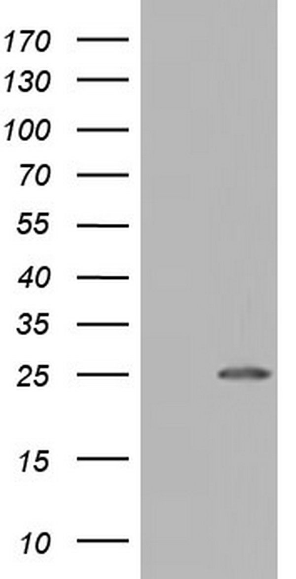 HEK293T cells were transfected with the pCMV6-ENTRY control (Left lane) or pCMV6-ENTRY NUDT10 (Right lane) cDNA for 48 hrs and lysed. Equivalent amounts of cell lysates (5 ug per lane) were separated by SDS-PAGE and immunoblotted with anti-NUDT10.