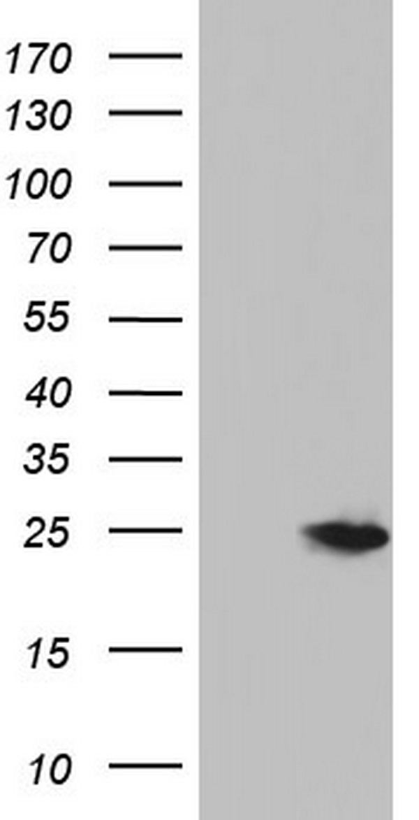 HEK293T cells were transfected with the pCMV6-ENTRY control (Left lane) or pCMV6-ENTRY NUDT10 (Right lane) cDNA for 48 hrs and lysed. Equivalent amounts of cell lysates (5 ug per lane) were separated by SDS-PAGE and immunoblotted with anti-NUDT10.