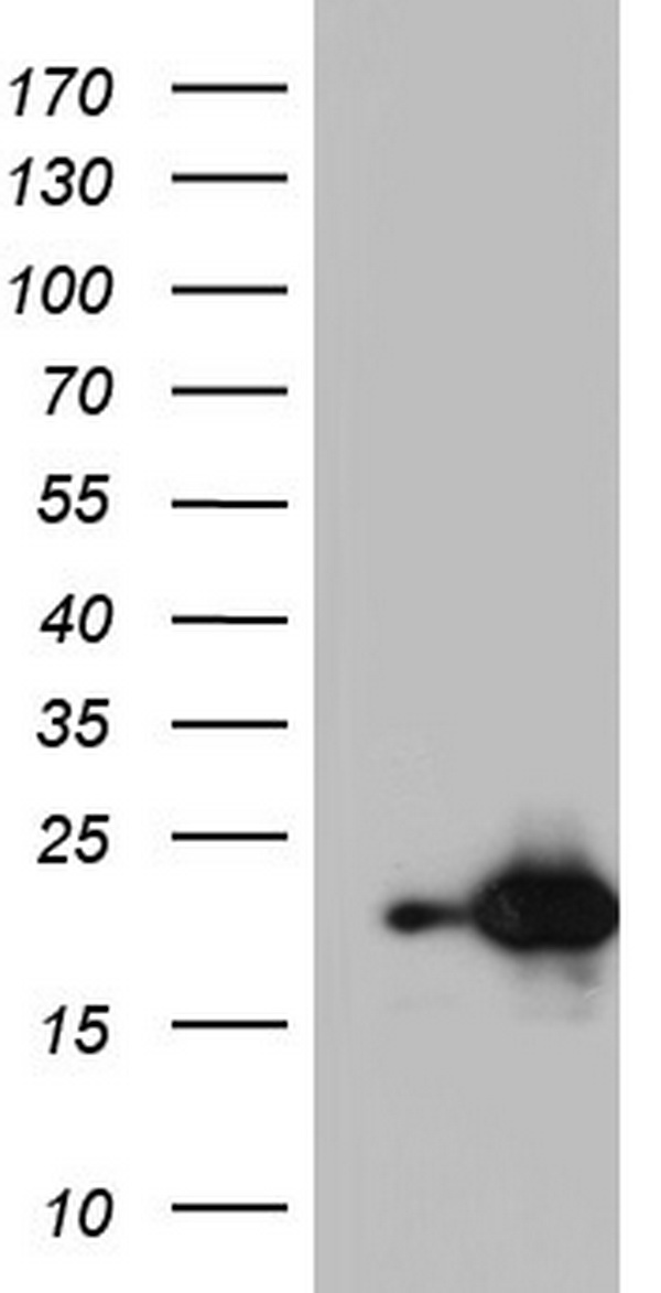 HEK293T cells were transfected with the pCMV6-ENTRY control (Left lane) or pCMV6-ENTRY NUDT10 (Right lane) cDNA for 48 hrs and lysed. Equivalent amounts of cell lysates (5 ug per lane) were separated by SDS-PAGE and immunoblotted with anti-NUDT10.
