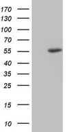 HEK293T cells were transfected with the pCMV6-ENTRY control (Left lane) or pCMV6-ENTRY NUDT12 (Right lane) cDNA for 48 hrs and lysed. Equivalent amounts of cell lysates (5 ug per lane) were separated by SDS-PAGE and immunoblotted with anti-NUDT12.