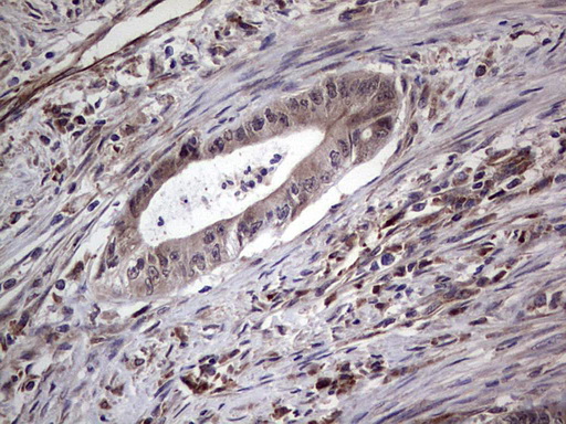 IHC of paraffin-embedded Human colon tissue using anti-NUDT12 mouse monoclonal antibody. (Heat-induced epitope retrieval by 1 mM EDTA in 10mM Tris, pH8.5, 120°C for 3min).