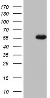 HEK293T cells were transfected with the pCMV6-ENTRY control (Left lane) or pCMV6-ENTRY NUDT12 (Right lane) cDNA for 48 hrs and lysed. Equivalent amounts of cell lysates (5 ug per lane) were separated by SDS-PAGE and immunoblotted with anti-NUDT12.