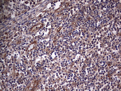 IHC of paraffin-embedded Human tonsil using anti-NUDT12 mouse monoclonal antibody. (Heat-induced epitope retrieval by 1 mM EDTA in 10mM Tris, pH8.5, 120°C for 3min).